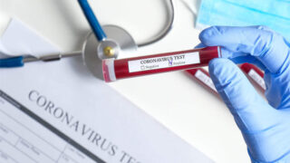 ناد مغربي يسجل إصابة 24 لاعبا وإداريا بفيروس كورونا